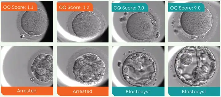 全球首例！18年绝望一夜逆转，AI找到仅有3颗精子，只要不到3000美元
