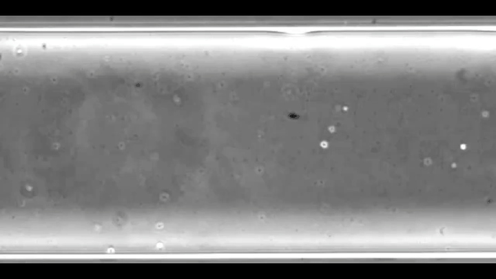 全球首例！18年绝望一夜逆转，AI找到仅有3颗精子，只要不到3000美元